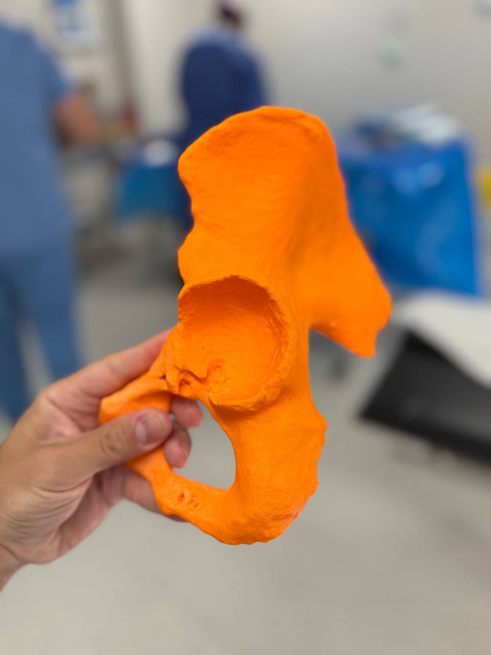 Patient-specific 3D pelvis model for hip implant planning