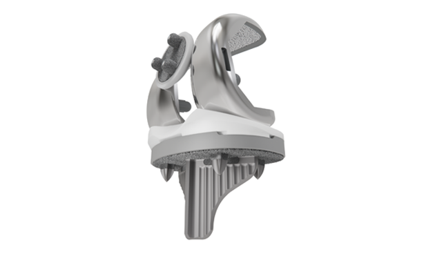 Stryker Triathlon Cementless — Porous cementless knee replacement components.