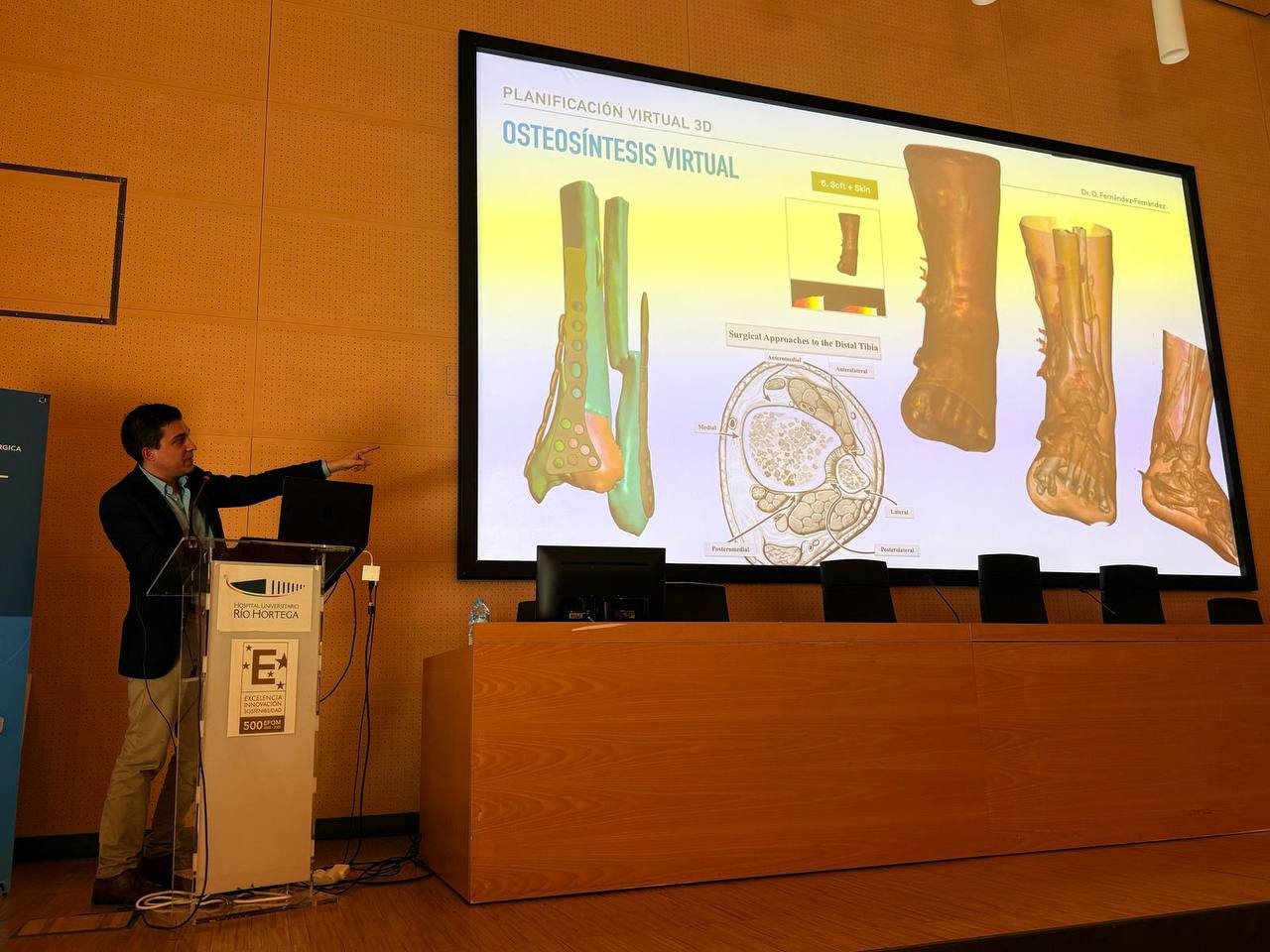 3D planning for complex orthopaedic cases