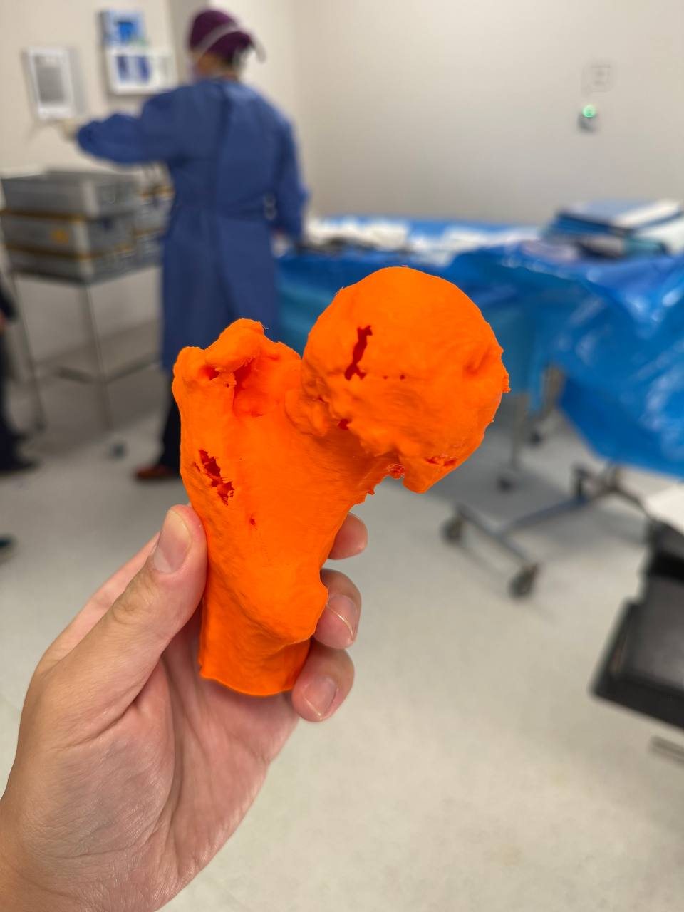 Orange 3D hip model used by DF Trauma